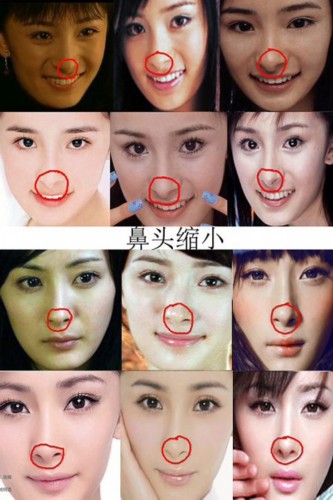 疑似整容部位：內(nèi)眼角