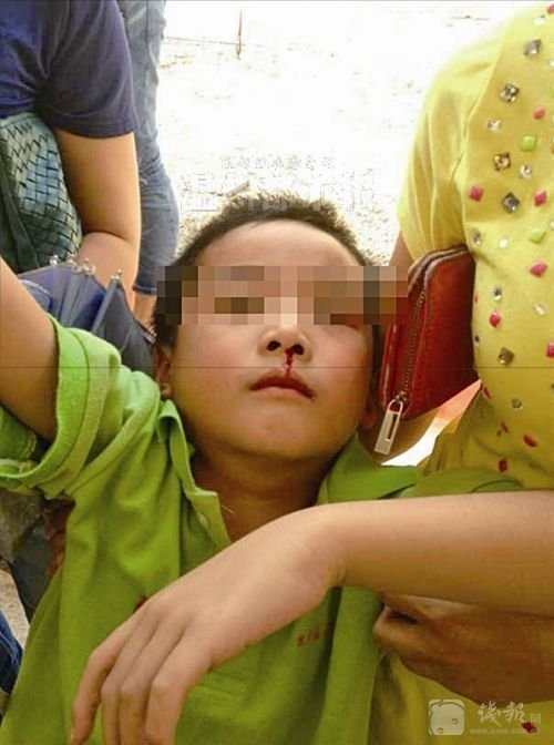 溫州樂清市北白象鎮第九小學19名學生氣體中毒