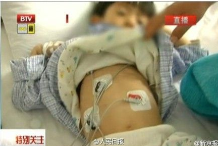 5歲男童被灌大量汞