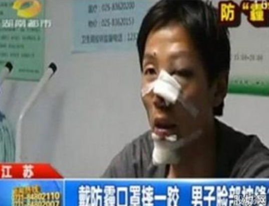 口罩傷臉