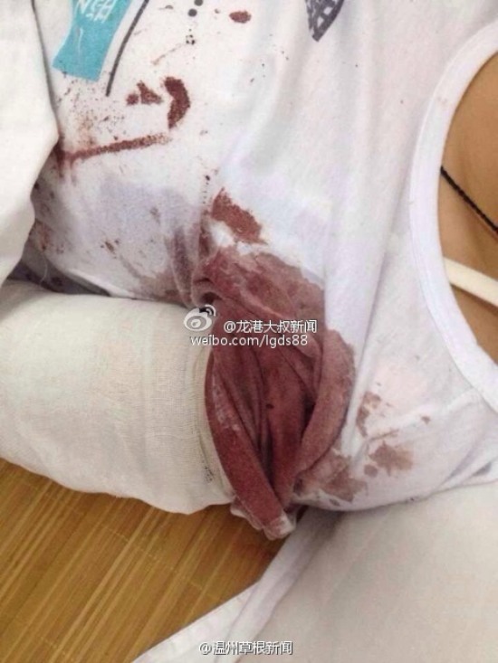 蒼南龍港第九中學(xué)女生用剪刀捅傷同學(xué)