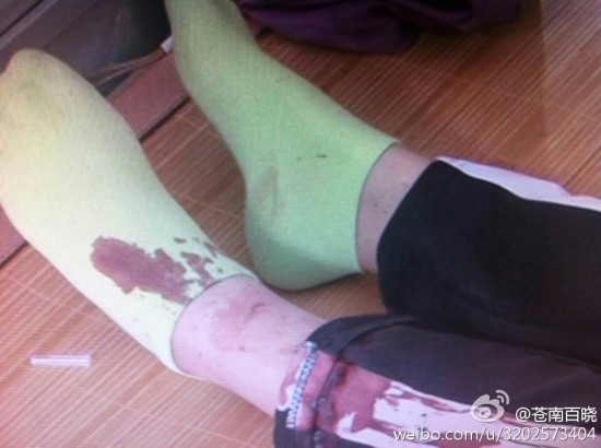 蒼南龍港第九中學(xué)女生用剪刀捅傷同學(xué)