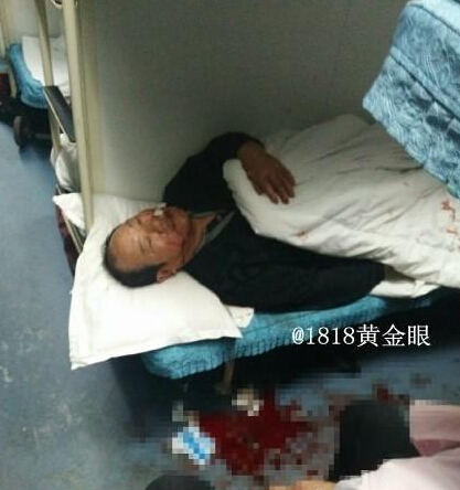 列車(chē)上男子用滅火器砸傷多人