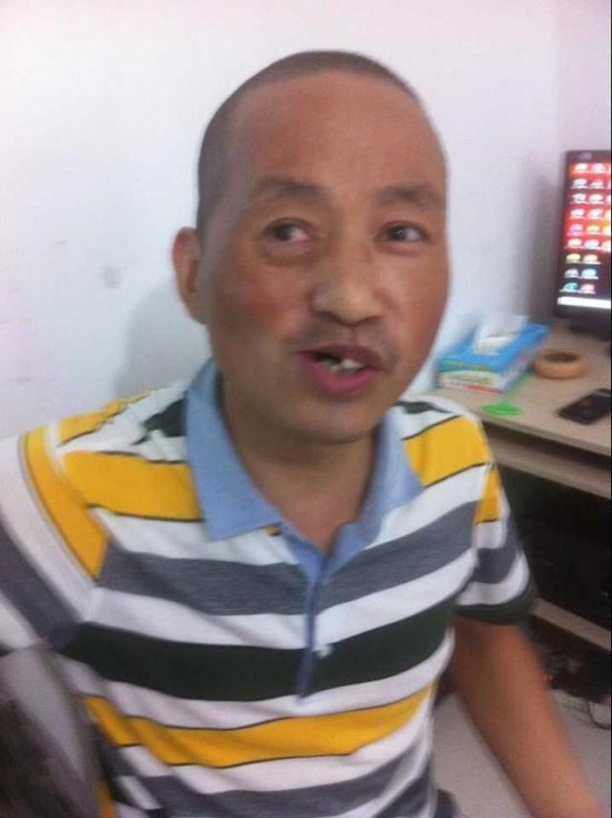 男子購刀自切腫瘤