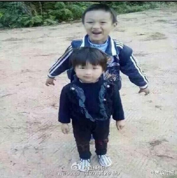兄妹被人強(qiáng)灌硫酸