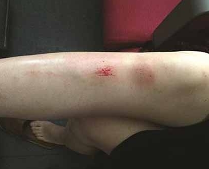 女子掉進站臺縫隙