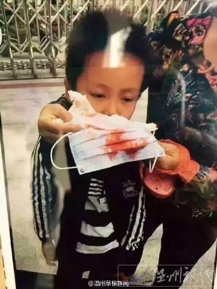 多名小學生出現流鼻血