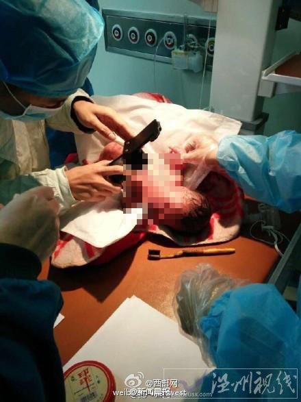 陜西渭南一女孩產子用竹簽將孩子刺死