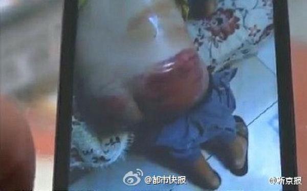 體罰學(xué)生打斷掃把