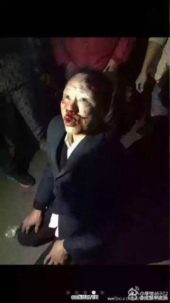 人販子當(dāng)街搶娃被群眾圍毆