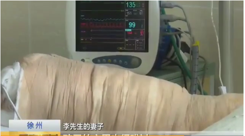 點(diǎn)蚊香引燃父親