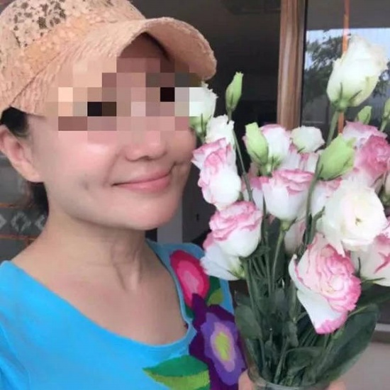 60歲老賴整成少女，頸部的皺紋暴露了老年的秘密