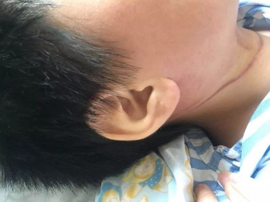 男孩腳一滑被上吊差點(diǎn)沒(méi)命