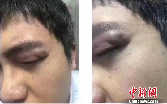 蘭大毆打醫生被拘