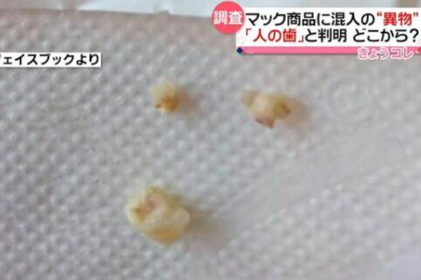 麥當勞吃出3顆牙