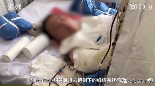 女子燒香掉香灰池導致燒傷