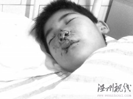 命危男孩救命捐款在醫院遭遇用錯藥和收錯費